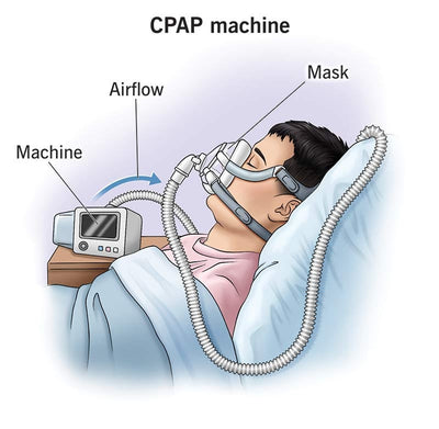 CPAP, BiPAP & CPAP Alternatives: Breathing Easier with the Right Therapy