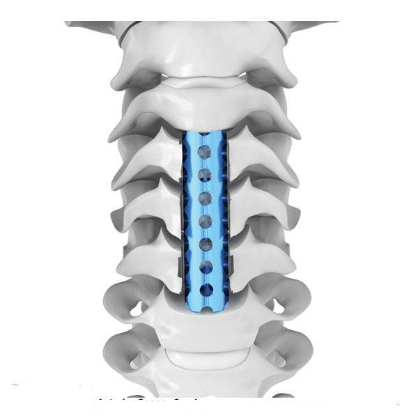 Anterior Spacer Cervical ETHAN