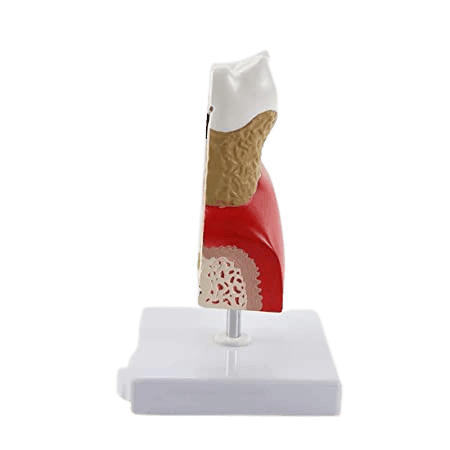 Dental Detachable Model