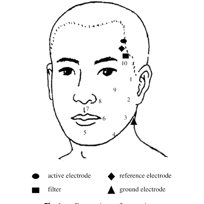 Facial Acupuncture: A Natural Route to Radiant Skin