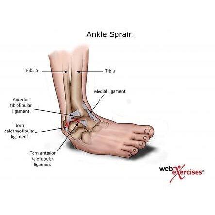 ANKLE JOINT CORRECTING BOARD