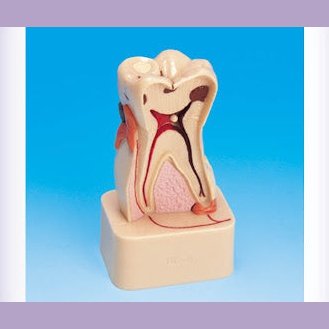 Dental Detachable Model