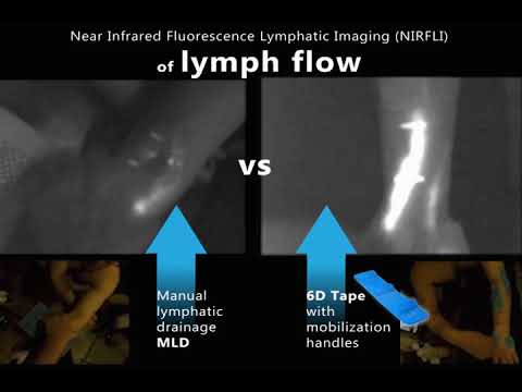 6D Tape For Tennis Elbow
